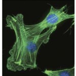 72 fibroblasts cyto10016