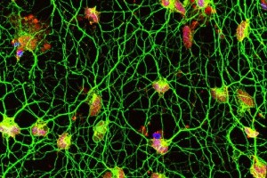 motor neurons from skin cells